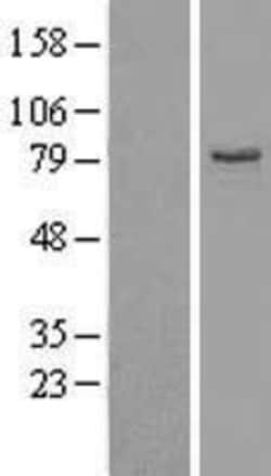 Novus Biologicals&trade;&nbsp;EHHADH Overexpression Lysate