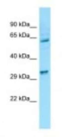 EI24 Antibody, Novus Biologicals 100&mu;L; Unlabeled:Antibodies, Polyclonal