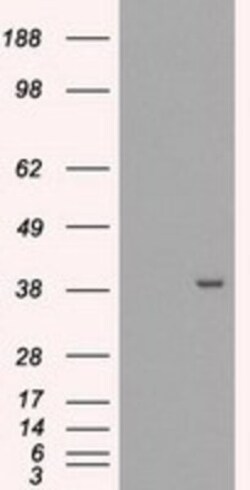 EI2BL Antibody (OTI9H7), Novus Biologicals 0.1mL; Unlabeled:Antibodies,