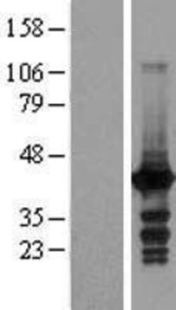 Novus Biologicals™ EI2BL Overexpression Lysate