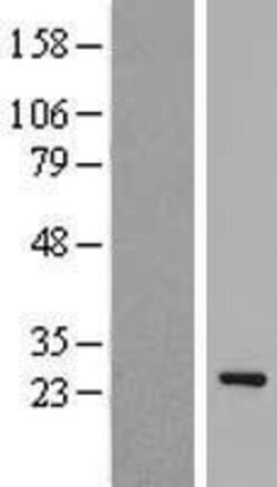 Novus Biologicals&trade;&nbsp;EID1 Overexpression Lysate