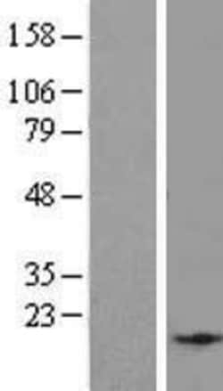 Novus Biologicals&trade;&nbsp;EID2B Overexpression Lysate