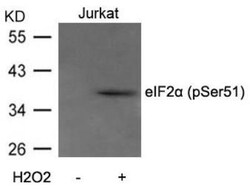 eIF2A, p Ser51 Antibody, Novus Biologicals 0.05 mg; Unconjugated:Antibodies,