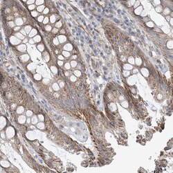 eIF2A Antibody, Novus Biologicals:Antibodies:Primary Antibodies