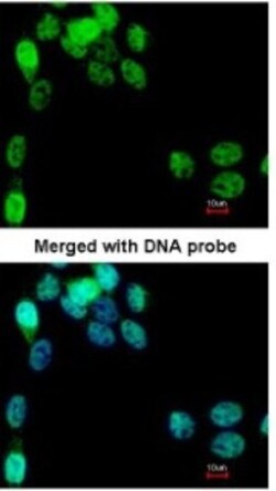 eIF2B epsilon Antibody, Novus Biologicals 100 &mu;L | Buy Online | Novus Biologicals | Fisher Scientific