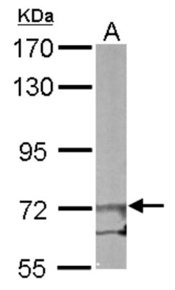 eIF2B epsilon Antibody, Novus Biologicals 100 &mu;L | Buy Online | Novus Biologicals | Fisher Scientific