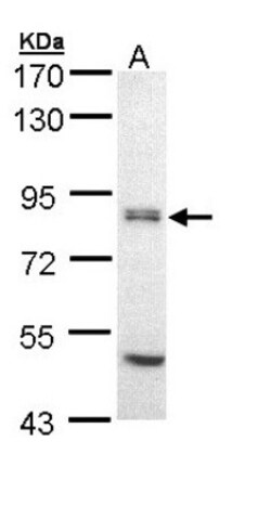 eIF2B epsilon Antibody, Novus Biologicals 100 &mu;L | Buy Online | Novus Biologicals | Fisher Scientific