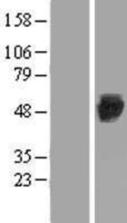 Novus Biologicals&trade;&nbsp;eIF2B3 Overexpression Lysate