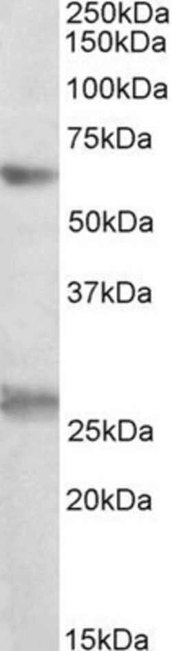 eIF2B4 Antibody, Novus Biologicals 0.1mg; Unlabeled:Antibodies, Polyclonal