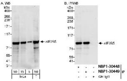 eIF2B epsilon Antibody, Novus Biologicals 100 &mu;L | Buy Online | Novus Biologicals | Fisher Scientific