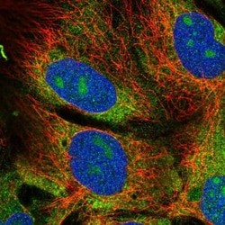 EIF2 beta Antibody, Novus Biologicals 0.1mL; Unlabeled:Antibodies, Polyclonal