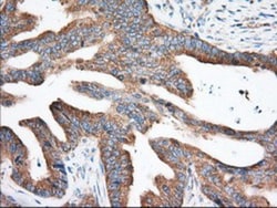 eIF2 alpha/EIF2S1 Antibody (OTI3H4), Novus Biologicals 0.1mL; Unlabeled:Antibodies,