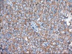 eIF2 alpha/EIF2S1 Antibody (OTI3H4), Novus Biologicals 0.1mL; Unlabeled:Antibodies,