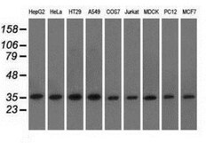 eIF2 alpha/EIF2S1 Antibody (OTI3H4), Novus Biologicals 0.1mL; Unlabeled:Antibodies,
