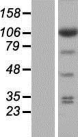 Novus Biologicals&trade;&nbsp;EIF3C Overexpression Lysate