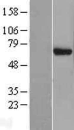 Novus Biologicals&trade;&nbsp;EIF3D Overexpression Lysate