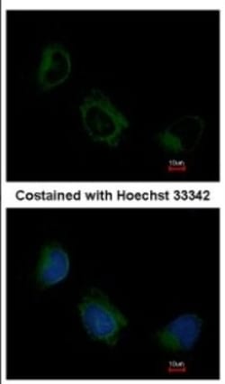 EIF3F Antibody, Novus Biologicals 0.1mL; Unlabeled:Antibodies, Polyclonal