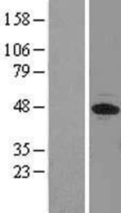 Novus Biologicals&trade;&nbsp;EIF3F Overexpression Lysate
