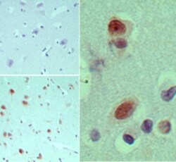 EIF3G Antibody, Novus Biologicals 0.1mg; Unlabeled:Antibodies, Polyclonal