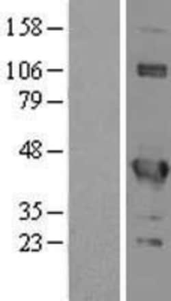 Novus Biologicals&trade;&nbsp;EIF3G Overexpression Lysate