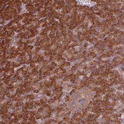 EIF3J Antibody, Novus Biologicals 0.1mL; Unlabeled:Antibodies, Polyclonal