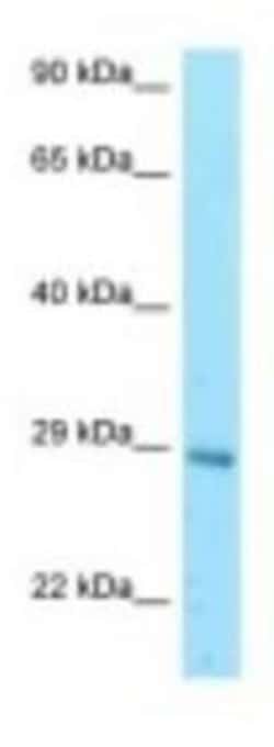 eIF3K Antibody, Novus Biologicals:Antibodies:Primary Antibodies