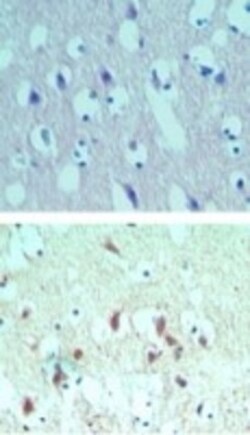 anti-eIF4A2, Polyclonal, Novus Biologicals 0.025mg; Unlabeled:Antibodies,