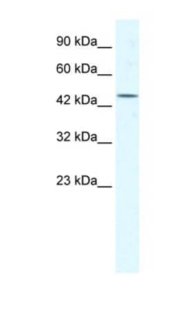 EIF4A3 Antibody, Novus Biologicals 100&mu;L; Unlabeled:Antibodies, Polyclonal