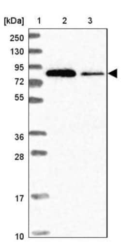 eIF4B Antibody, Novus Biologicals 25 &mu;L | Buy Online | Novus Biologicals | Fisher Scientific