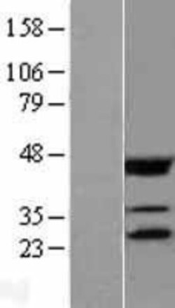 Novus Biologicals&trade;&nbsp;eIF4E Overexpression Lysate