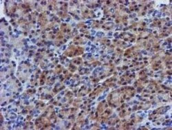 eIF4E Antibody (5D11), Novus Biologicals 0.025 mL, Unconjugated:Antibodies,