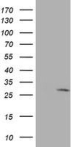 eIF4E Antibody (5D11), Novus Biologicals 0.025 mL, Unconjugated:Antibodies,
