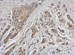 4EBP1 Antibody, Novus Biologicals 0.1mL; Unlabeled:Antibodies, Polyclonal