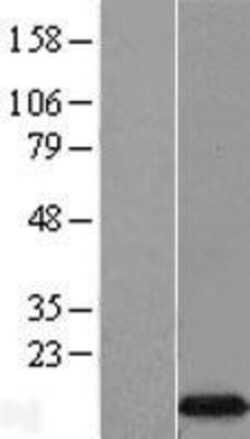Novus Biologicals™ EIF4EBP3 Overexpression Lysate