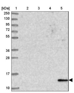 EIF4EBP3 Antibody, Novus Biologicals 0.1mL; Unlabeled:Antibodies, Polyclonal
