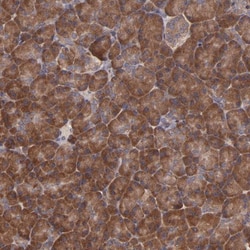 eIF4ENIF1 Antibody, Novus Biologicals:Antibodies:Primary Antibodies