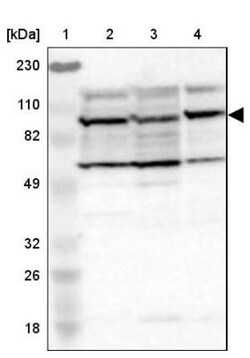 eIF4ENIF1 Antibody, Novus Biologicals 0.1mL; Unlabeled:Antibodies, Polyclonal