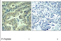 eIF4G1, p Ser1231 Antibody, Novus Biologicals 0.1 mg; Unconjugated:Antibodies,