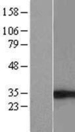Novus Biologicals&trade;&nbsp;eIF4H Overexpression Lysate
