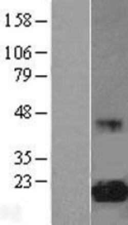 Novus Biologicals&trade;&nbsp;eIF5A Overexpression Lysate