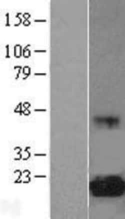 Novus Biologicals&trade;&nbsp;eIF5A Overexpression Lysate