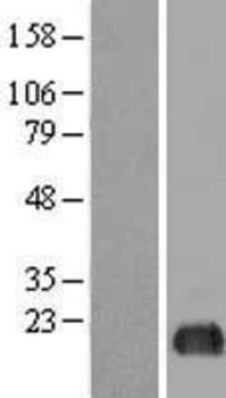 Novus Biologicals&trade;&nbsp;eIF5A2 Overexpression Lysate