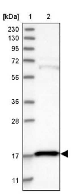 eIF5A2 Antibody, Novus Biologicals:Antibodies:Primary Antibodies