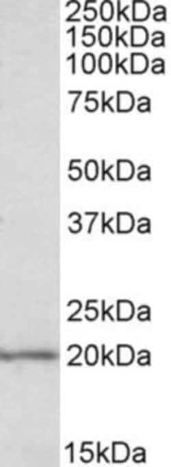 eIF5A Antibody, Novus Biologicals 0.1mg; Unlabeled:Antibodies, Polyclonal