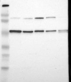 EIF5 Antibody, Novus Biologicals 25 &mu;L; Unlabeled:Antibodies, Polyclonal