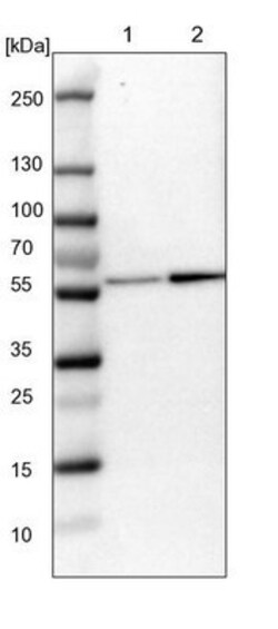 EIF5 Antibody, Novus Biologicals 25 &mu;L; Unlabeled:Antibodies, Polyclonal