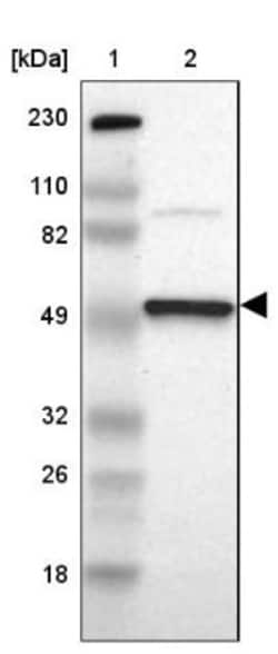EIF5 Antibody, Novus Biologicals 25 &mu;L; Unlabeled:Antibodies, Polyclonal