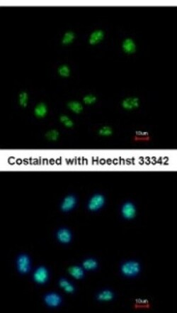 ELAC1 Antibody, Novus Biologicals 0.1mL; Unlabeled:Antibodies, Polyclonal