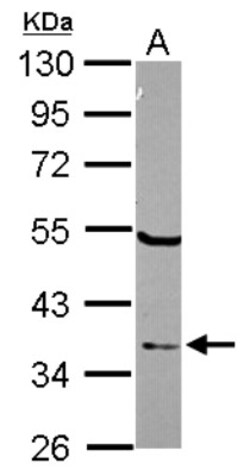 ELAC1 Antibody, Novus Biologicals 0.1mL; Unlabeled:Antibodies, Polyclonal
