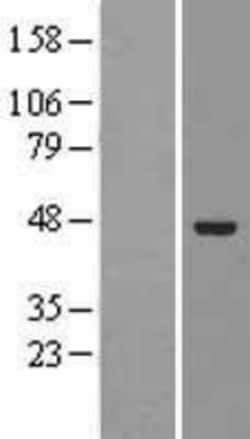Novus Biologicals&trade;&nbsp;ELAC1 Overexpression Lysate